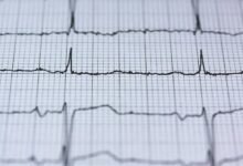 global revenue growth initiative